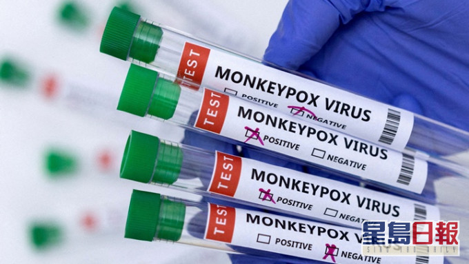 中国疾控中心指内地暂未发现猴痘病例。 路透社资料图片