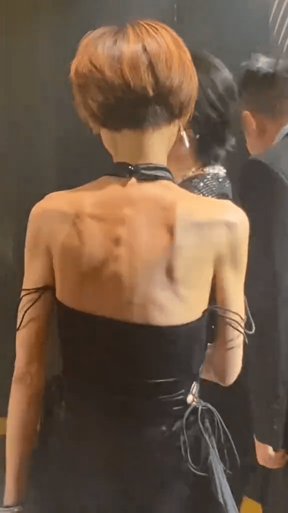 叶子楣一转身更瘦到脊骨及肩胛骨都凸晒出来! 叶子楣一转身更瘦到脊骨及肩胛骨都凸晒出来!