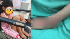 马来西亚女童遭邻居小孩“酷刑性虐”，警指疑犯仅6至8岁