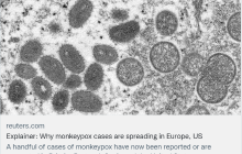 猴痘病例已在欧洲多国发现，专家：极其罕见