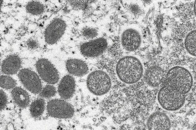 成熟猴痘病毒（左）和未成熟病毒粒子（右） 电子显微镜图像