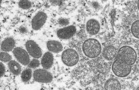 非洲今年已报告1597例猴痘病例，其中66例死亡