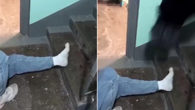 俄青年求朋友「踩斷腳」影片瘋傳。
