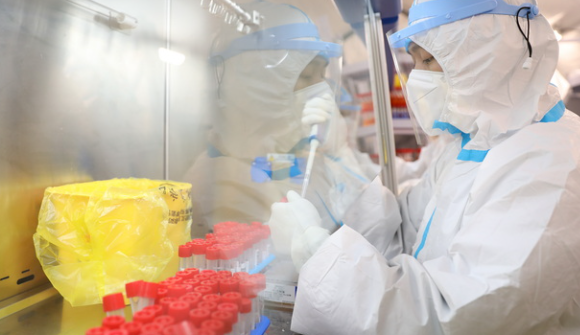 核酸检测 核酸检测