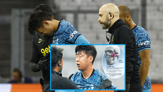 _2022110411084792597 _2022110411084792597