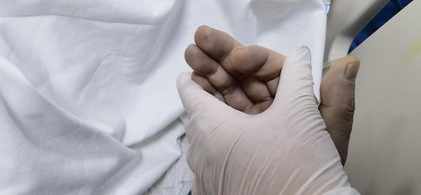 20221109_health_blueskin_1