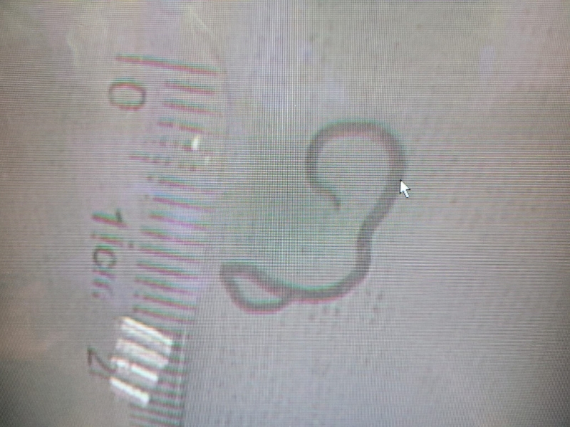 吳文傑醫生表示，病者因進食魚生後感染寄生蟲。（相片獲吳文傑醫生授權轉載） 