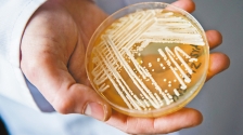 超级真菌个案激增成威胁，美疾控中心呼吁医院做足防控措施