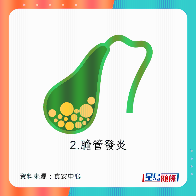 生吃淡水魚下場：膽管發炎