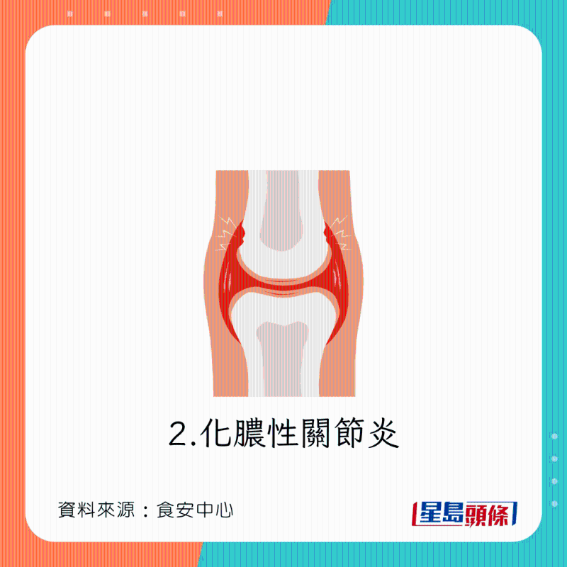 食淡水魚刺身下場：化膿性關節炎