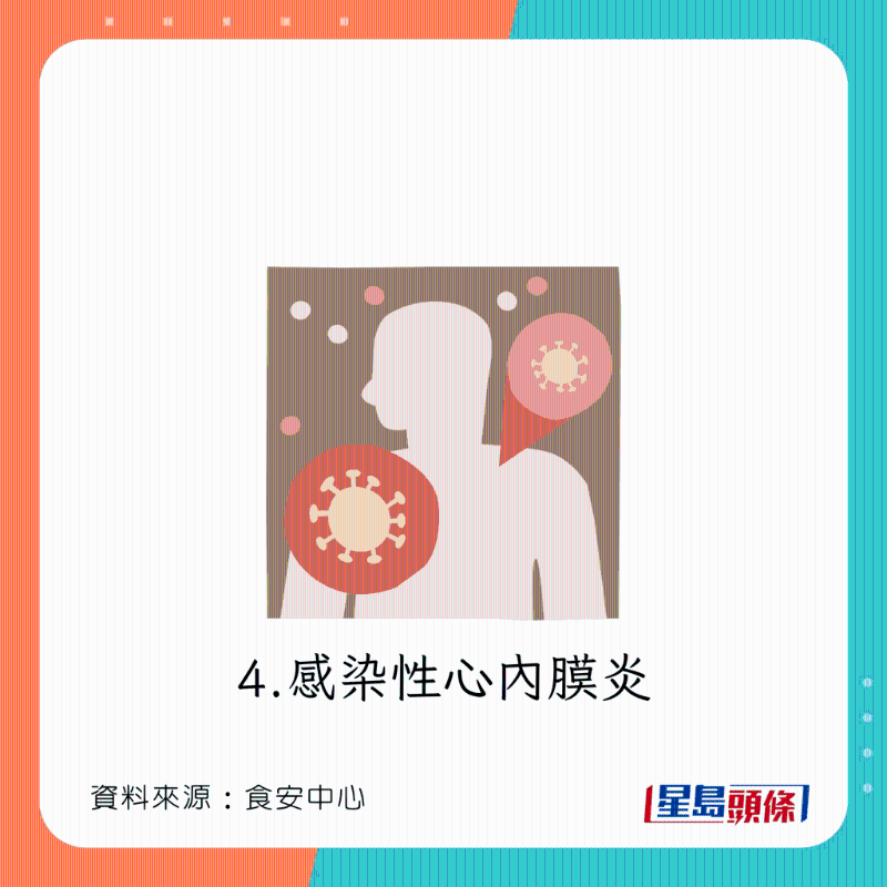 食淡水魚刺身下場：感染性心內膜炎