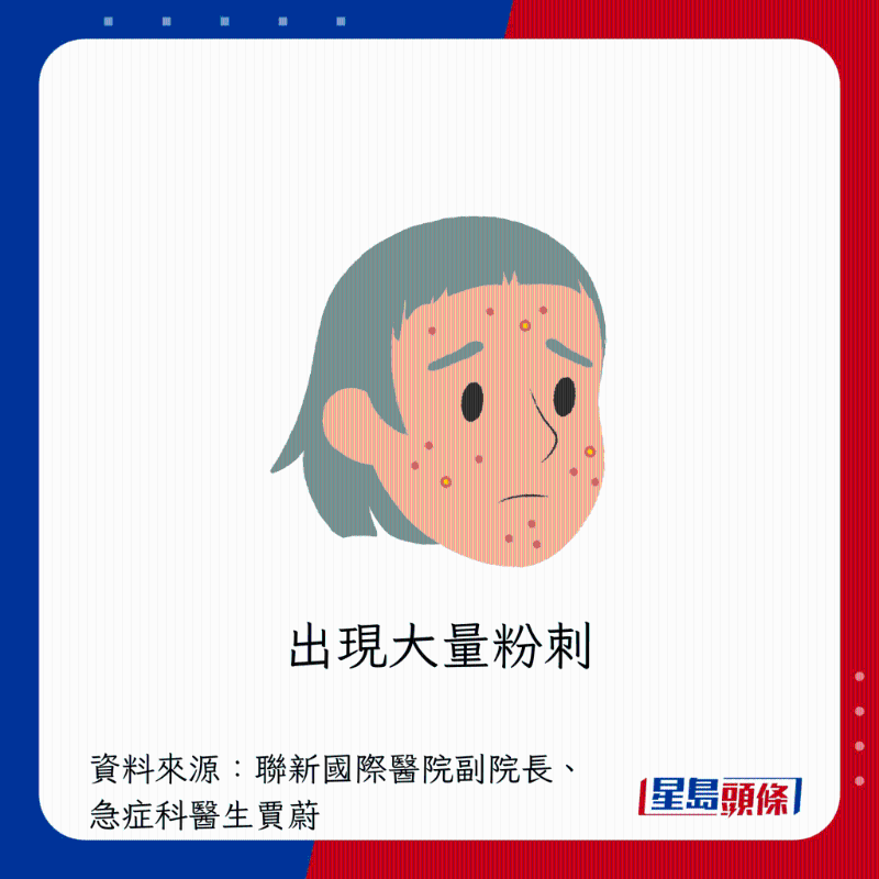  肝臟過勞警號：出現大量粉刺