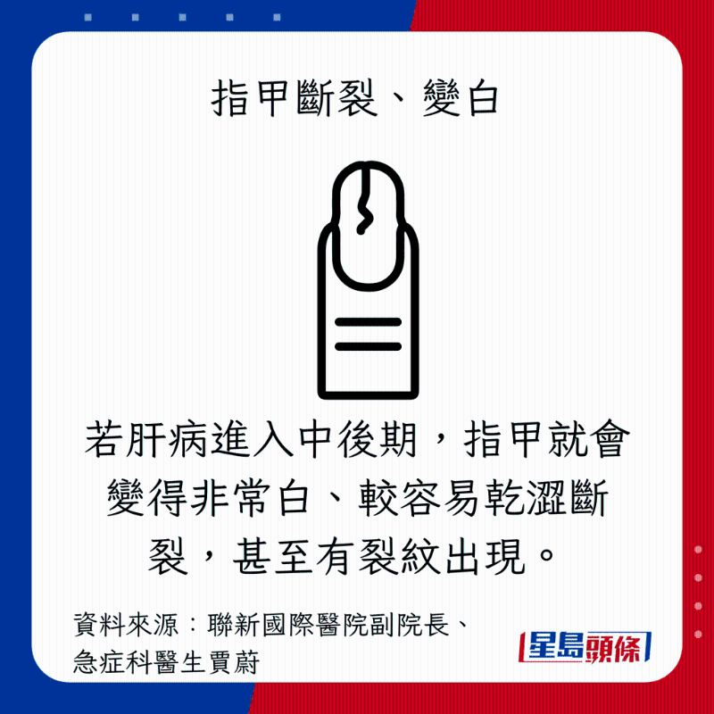  肝臟過勞警號：指甲斷裂、變白
