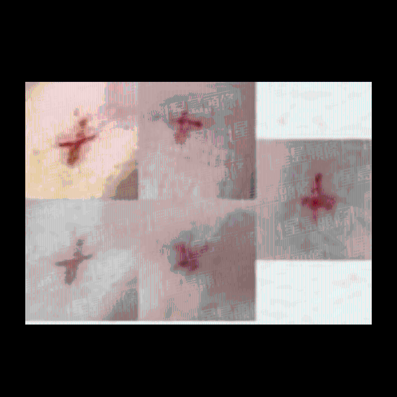 微创手术 微创手术