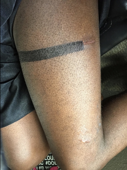 吉布森 说增高过程很痛 吉布森 说增高过程很痛