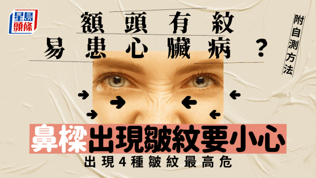 额头有横纹增心脏病风险？