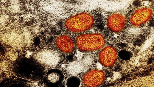 广州发现2宗猴痘病例