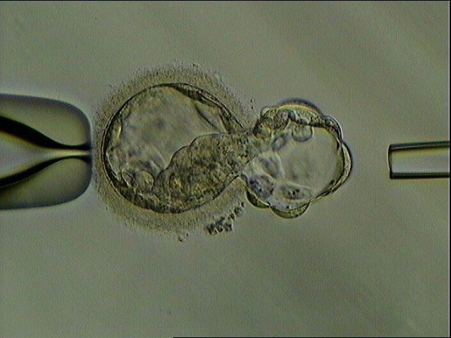 科学家成功利用干细胞创造出合成人类胚胎