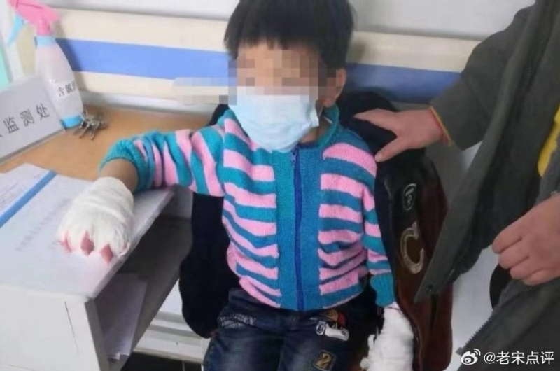 女孩惨遭虐待。