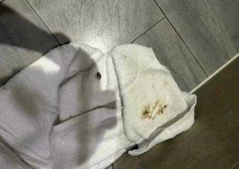 浴巾上疑似有排泄物。 微博 浴巾上疑似有排泄物。 微博