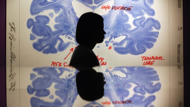 世界卫生组织估计抑郁症影响全球3亿多人,但目前还缺乏有效的治疗药物。 路透社 世界卫生组织估计抑郁症影响全球3亿多人,但目前还缺乏有效的治疗药物。 路透社