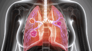常吸入厨房油烟易患肺癌！小心7大致癌环境，专家教10招防癌