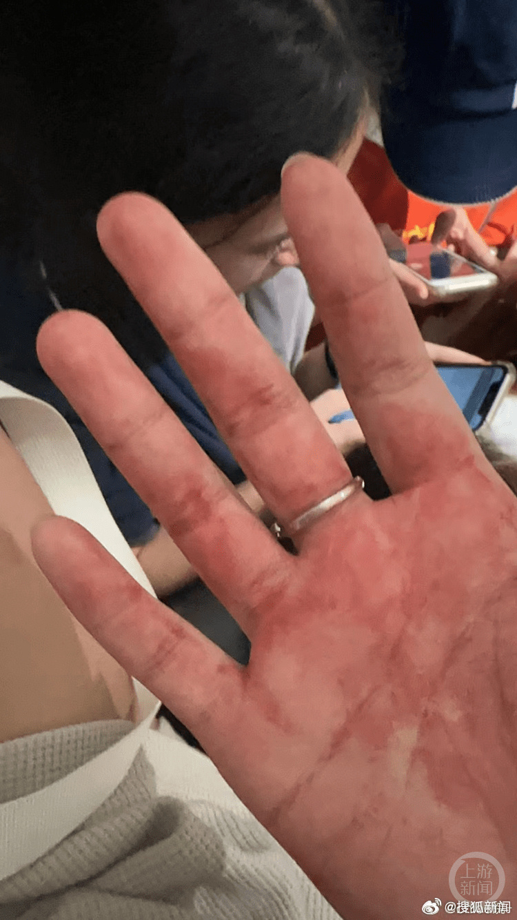 有中国游客事后展示自己手上有血。