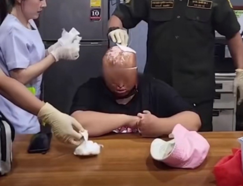 警员检查被捕乞丐的烫伤毁容痕迹。 警员检查被捕乞丐的烫伤毁容痕迹。