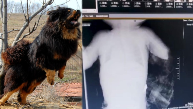 江西有年仅1岁半的男童被藏獒袭击,致左手臂被扯断。 江西有年仅1岁半的男童被藏獒袭击,致左手臂被扯断。