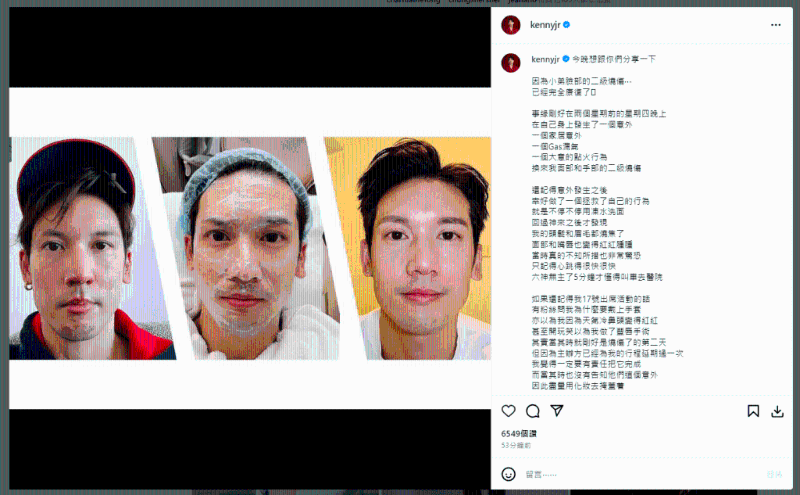 关智斌还撰文讲康复经过。