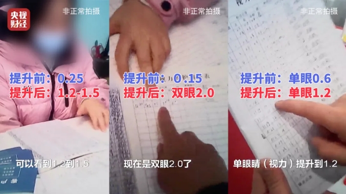 提升前后对比 提升前后对比