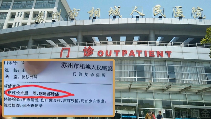 江苏苏州市相城人民医院摆大乌龙，女病人竟被诊断包皮过长。