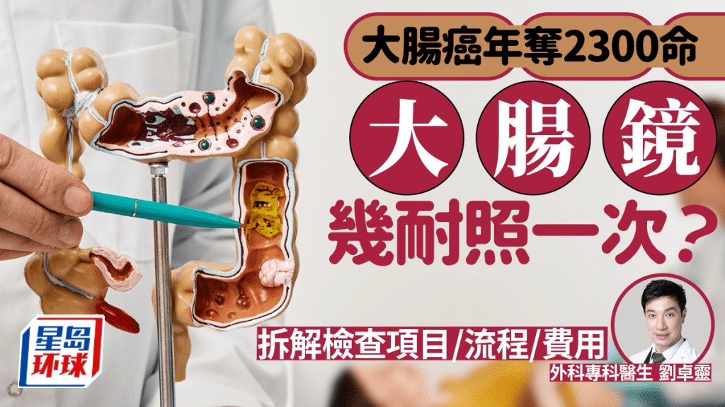 大肠镜检查 大肠镜检查