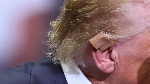 右耳贴上肉色胶布 右耳贴上肉色胶布