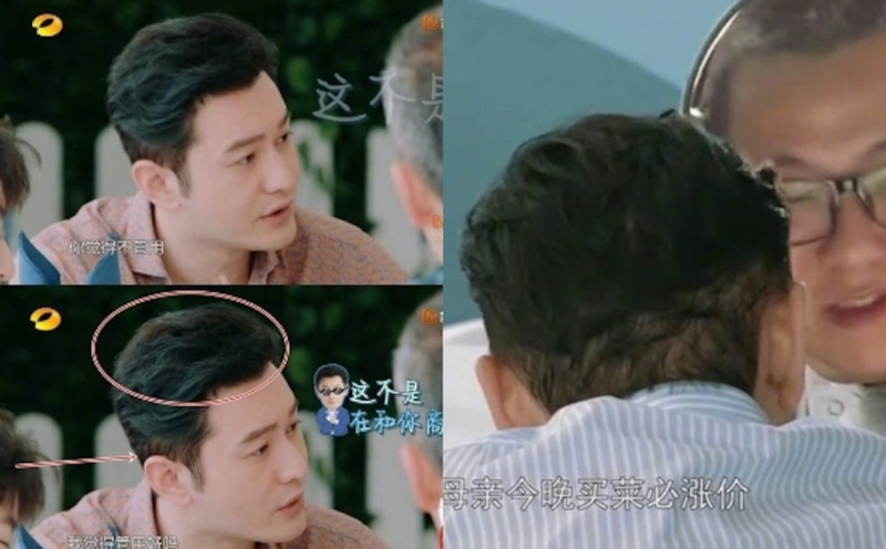 黄晓明早于内地节目《中餐厅3》时,已被质疑戴假发。 黄晓明早于内地节目《中餐厅3》时,已被质疑戴假发。