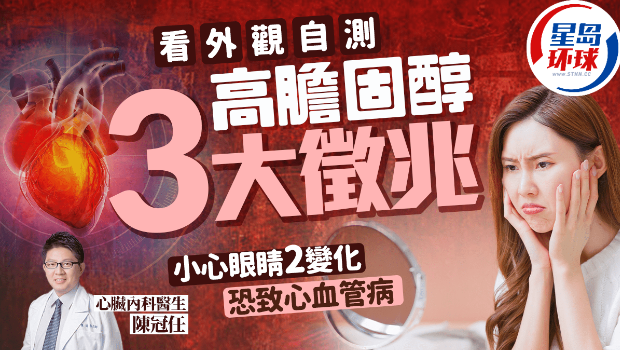 高胆固醇3大征兆 高胆固醇3大征兆