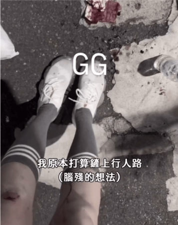 不小心被行人路的台阶绊倒 不小心被行人路的台阶绊倒