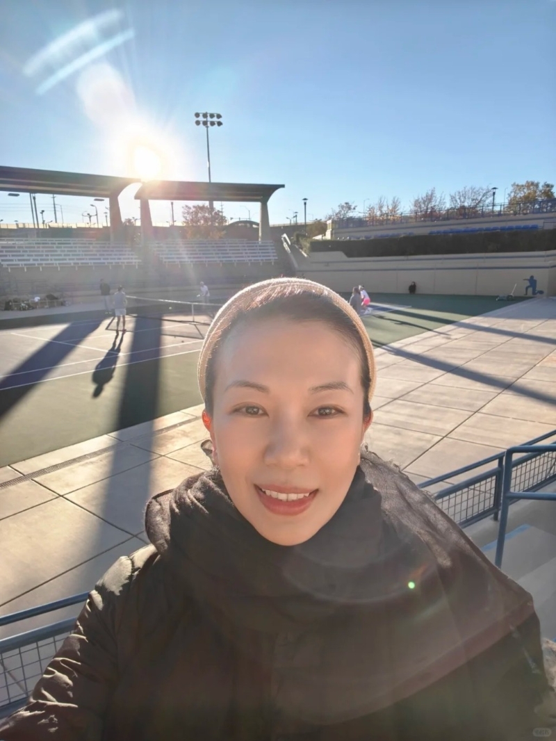 林有慧带上头箍示人,额头及面上零皱纹。 林有慧带上头箍示人,额头及面上零皱纹。