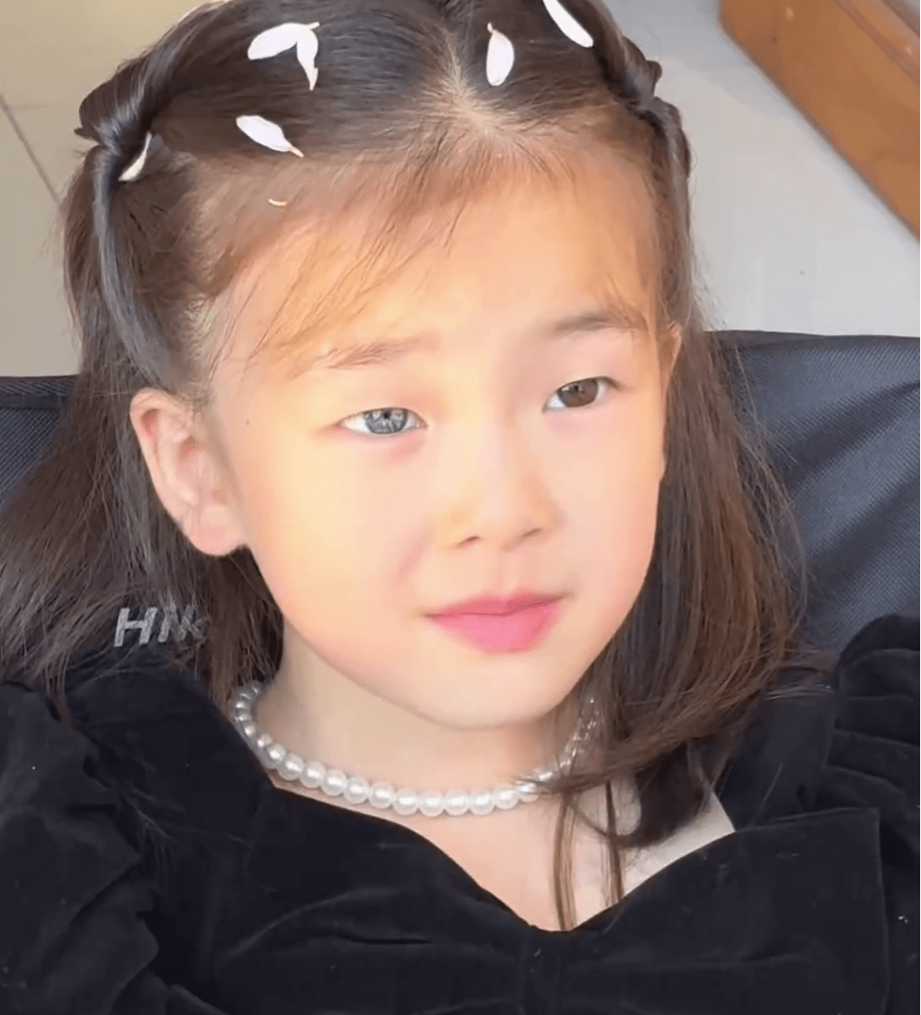 江西7岁女童天生异瞳,眼睛一黑一蓝。 江西7岁女童天生异瞳,眼睛一黑一蓝。