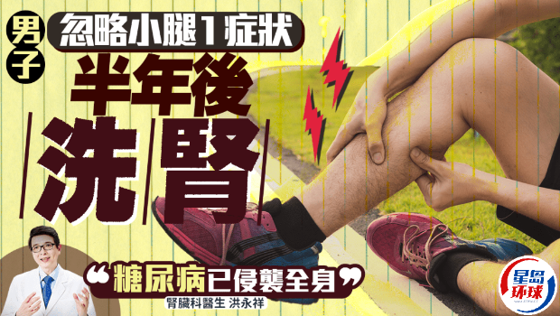 男子忽略小腿1症状 男子忽略小腿1症状