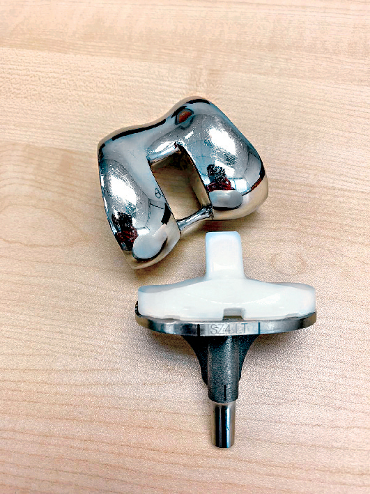 人工膝关节 人工膝关节