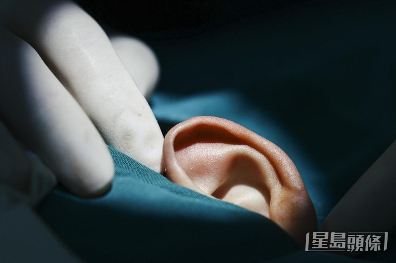 全港有逾4.4万人听觉有很大困难，当中有24%用助听器或人工耳蜗。