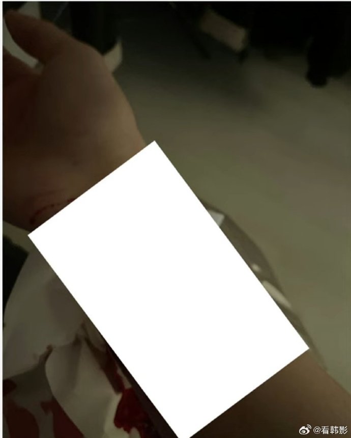 横竖研究所又公开声称金赛纶曾锽手达100次的照片。 横竖研究所又公开声称金赛纶曾锽手达100次的照片。