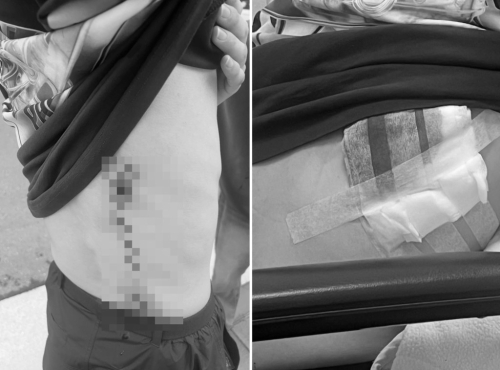 伤者展示其被斩伤势。 伤者展示其被斩伤势。