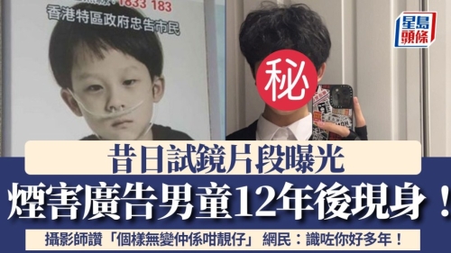 烟害广告男童12年后现身！