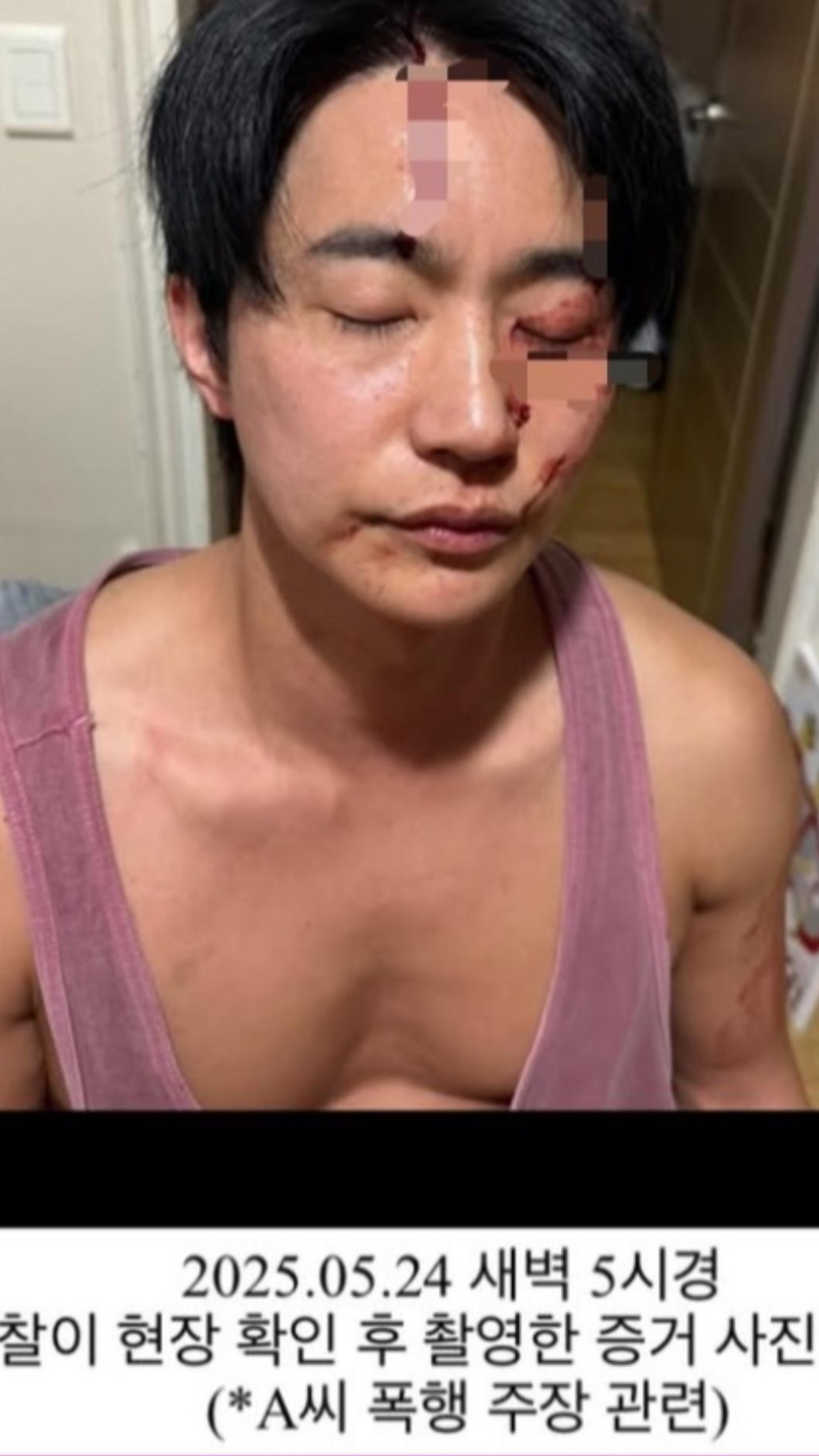 全浩俊晒出鼻青脸肿的照片回应。 （TVBS新闻网图片）