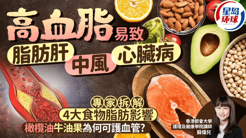 专家拆解4大食物脂肪影响 专家拆解4大食物脂肪影响