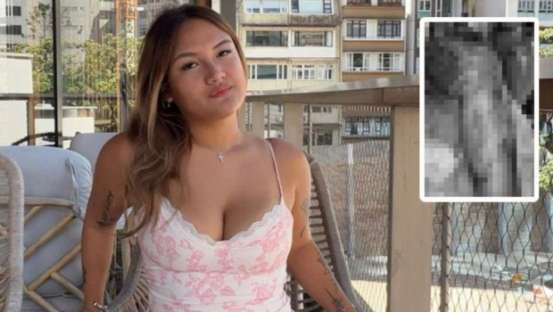 波士顿大学香港交换生因酒精爆炸身体3成烧伤