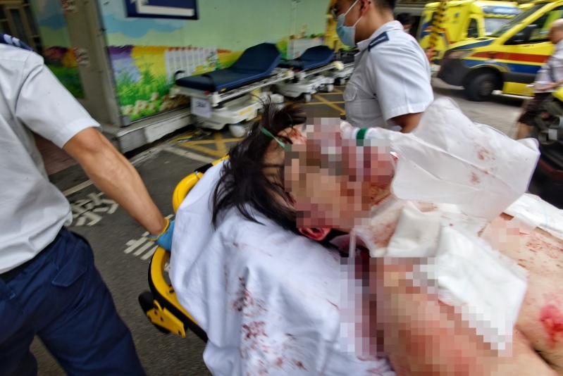 伤者送院抢救。