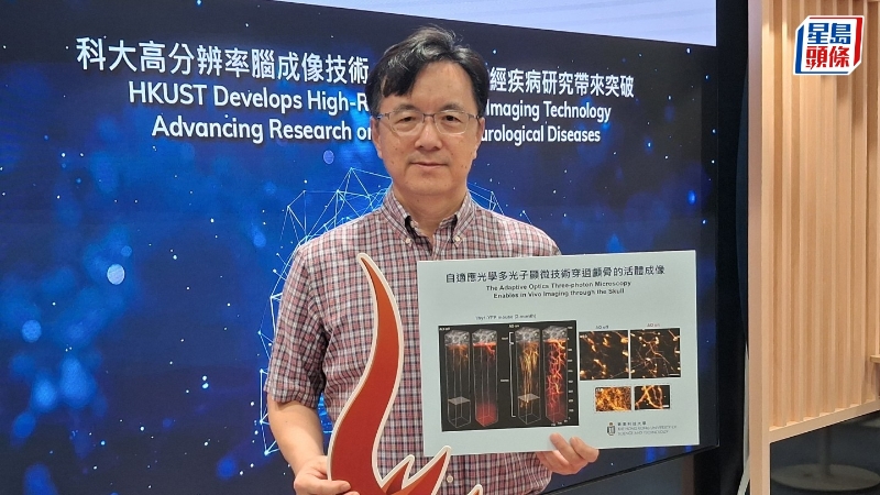 科大全球首创清醒小鼠高分辨率脑成像